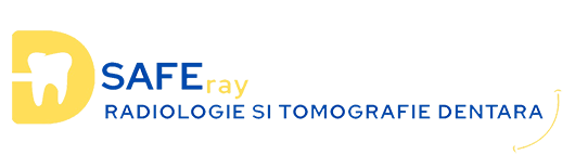 SafeRay